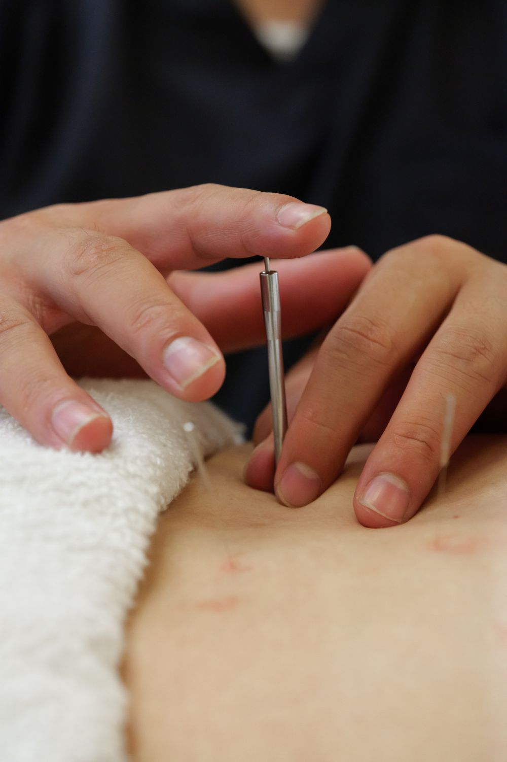 当グループの月経痛施術について