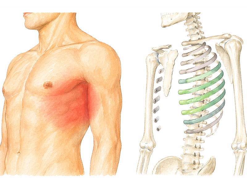 肋間神経痛の好発部と年齢